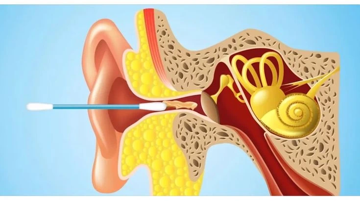 Qulaq Gigiyenası: Qulaqları Düzgün Təmizləmək və Eşitməni Qorumaq