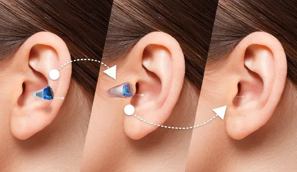 Gizli eşitmə cihazları  – Kimlər üçün uyğundur?